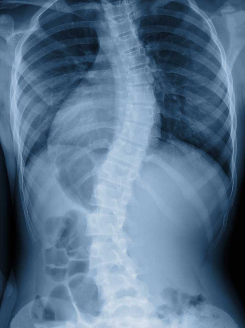 Digital X-Rays