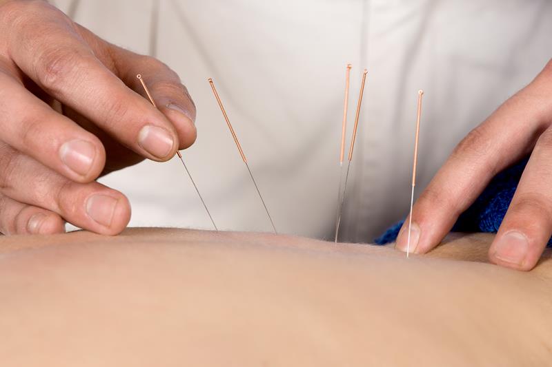 Needle-Free Acupuncture